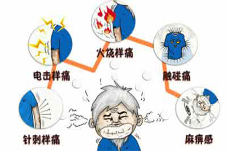 三叉神经痛是什么病?脸部出现撕裂样、烧灼样、触电样、刀割样、炸裂样的疼痛要注意了