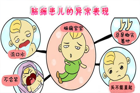 脑瘫怎么治疗比较好?微创矫形术或选择性脊神经后切断术都是脑瘫治疗优选