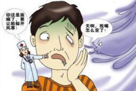 一时贪凉成面瘫 口眼歪斜